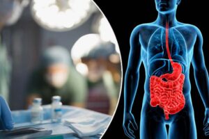 Χειρουργική Στομάχου