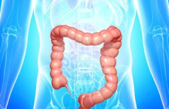 Χειουργική Παχέως Εντέρου