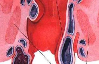 Χειρουργική Πρωκτού